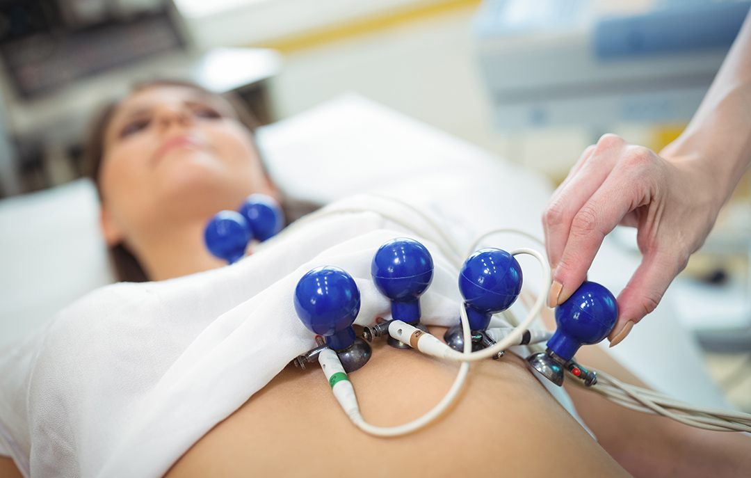 Electrocardiograma de Ritmo o de Superficie